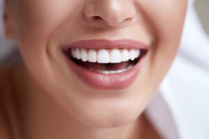 Facette dentaire - Pose de facettes chez votre dentiste à Javea